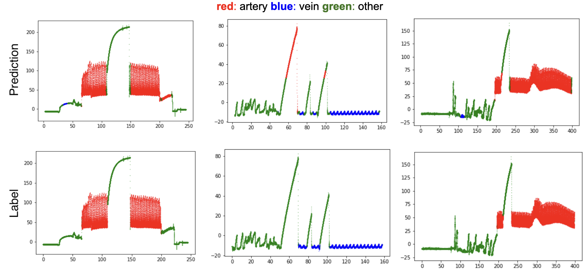 Vessel classification based on fourier analysis